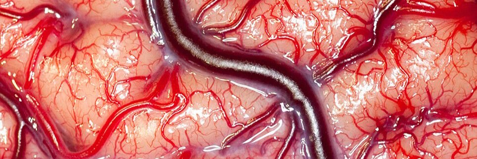 SyndromeMia's profile banner image