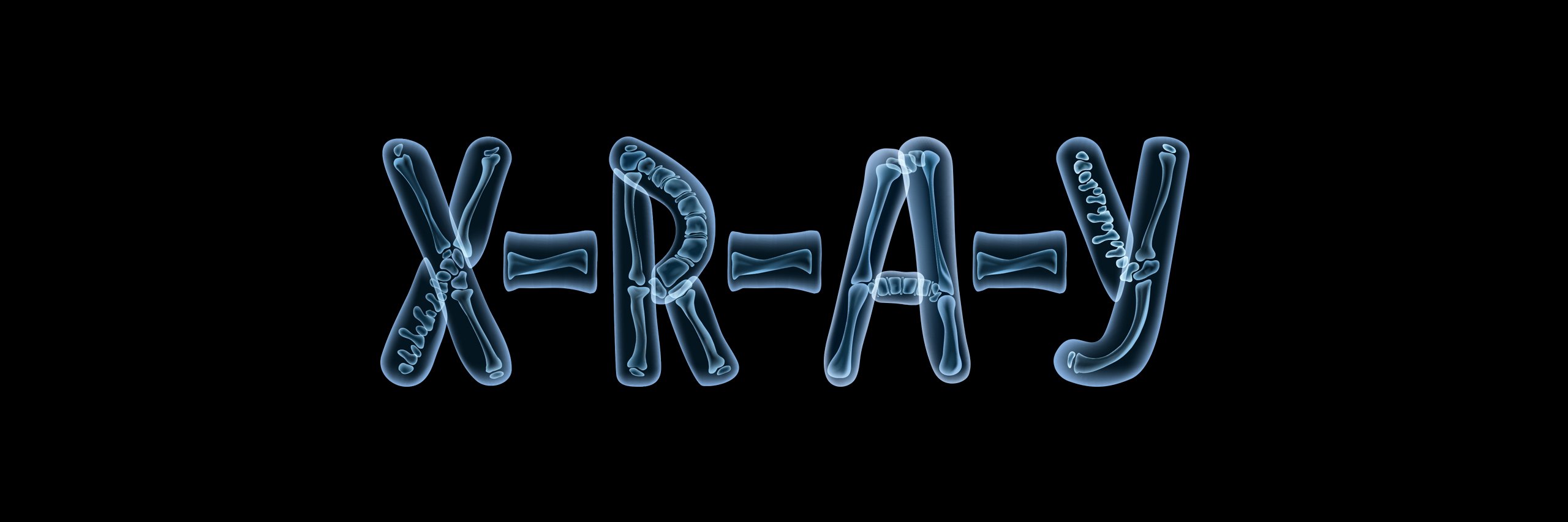 X-R-A-Y's banner