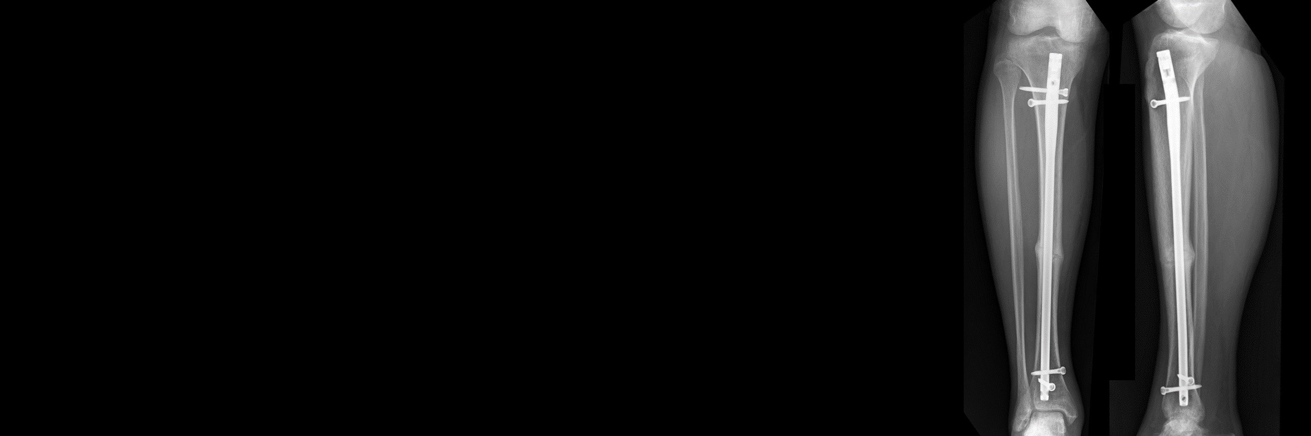 Hannah Dailey banner