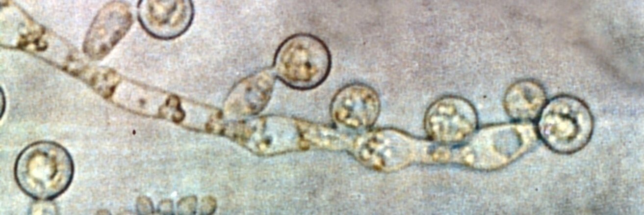 Candida Papers banner