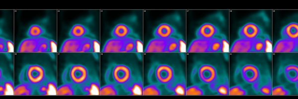 CVC_SNMMI Profile Banner