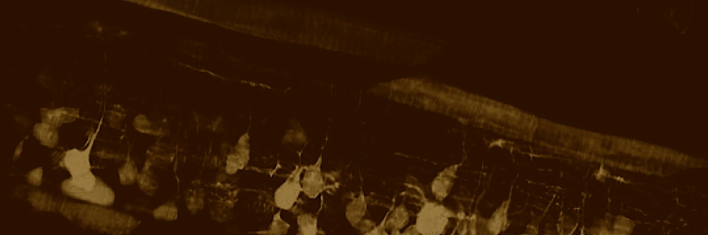 Zack Gow banner