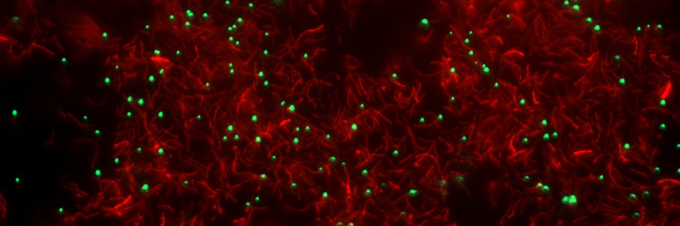 Irina Spacova banner