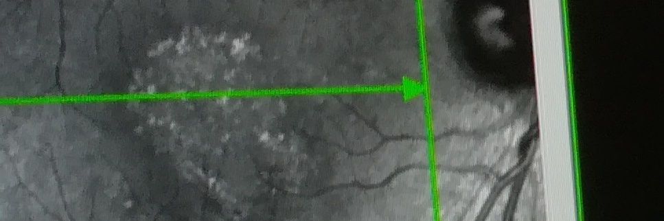 Tony Kirby, Commissions Open banner