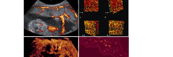 LopaLeach Profile Banner