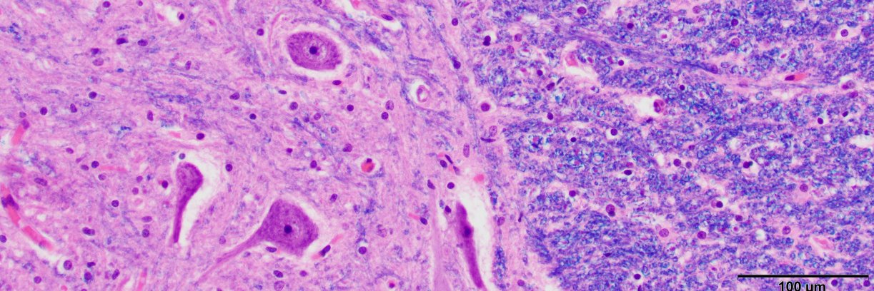 Karra Jones, MD, PhD banner