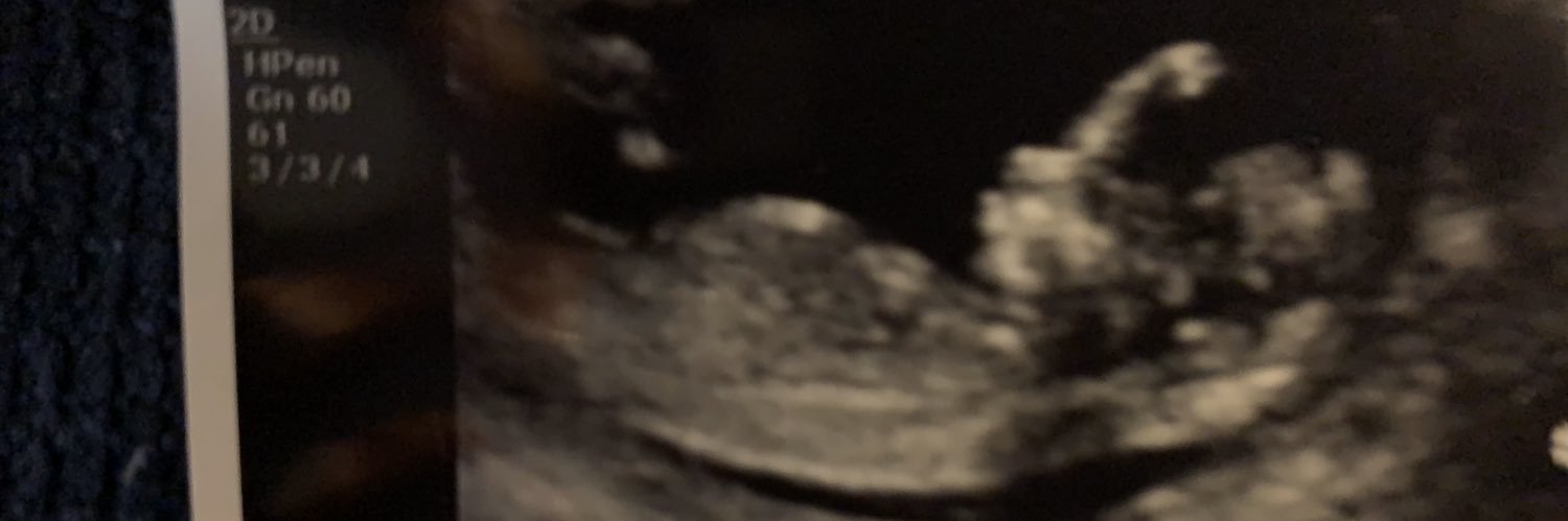lisherxd's profile banner image