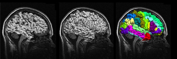 CyrilRPernet Profile Banner