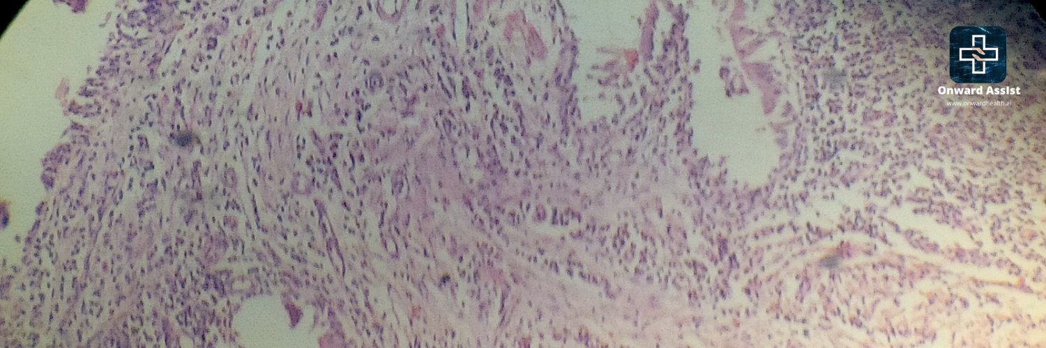 Onward Assist banner