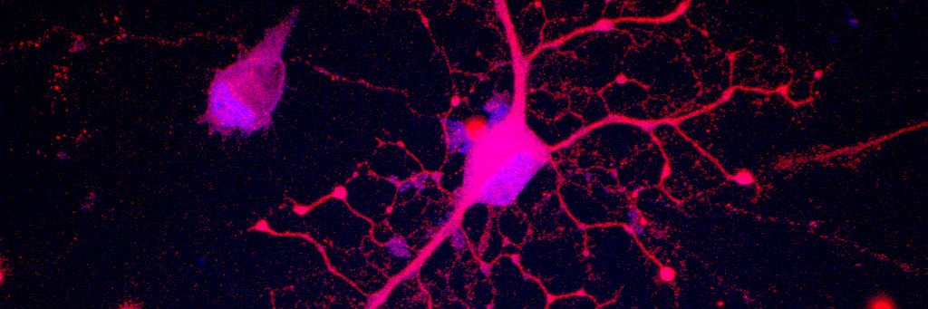 Neuropsicofarmacología molecular - UCM's banner