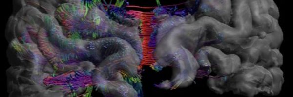alb_dl Profile Banner