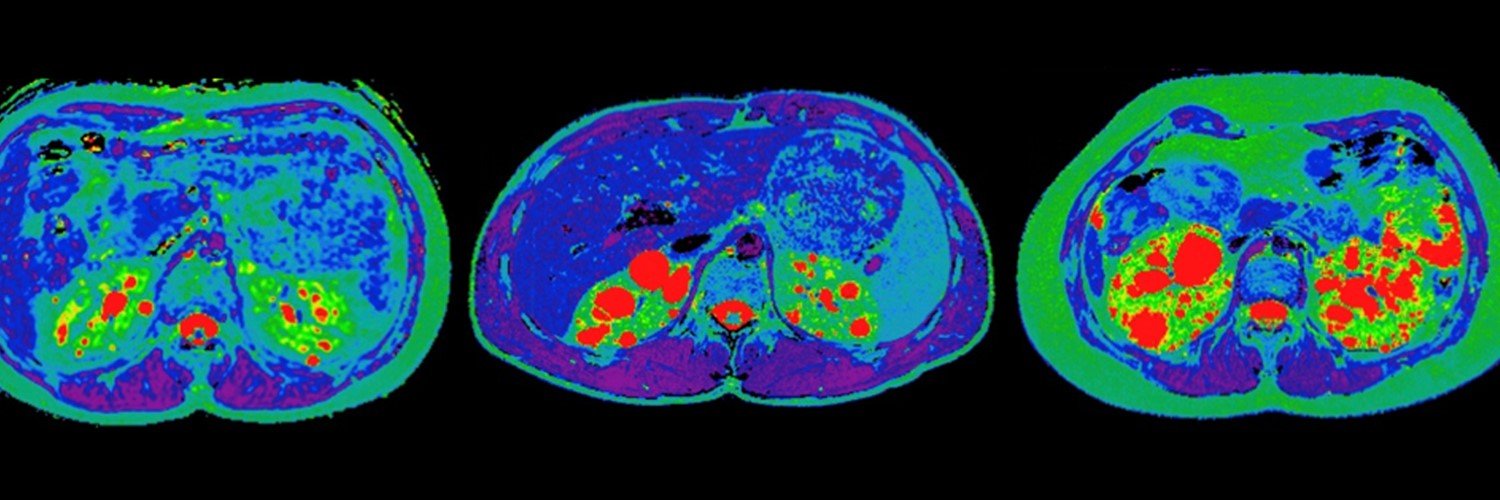 Kidney International banner