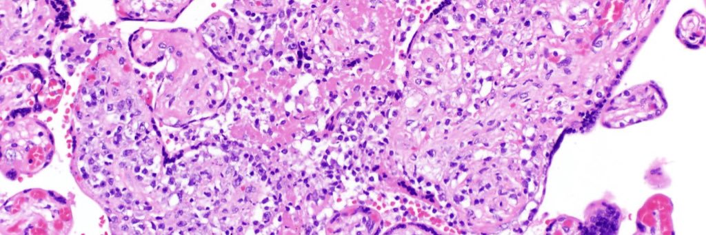 Sarah E Kerr, MD banner