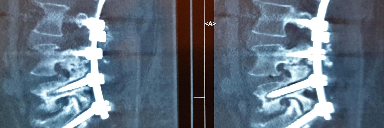 Dr. Spine, مَهدی banner