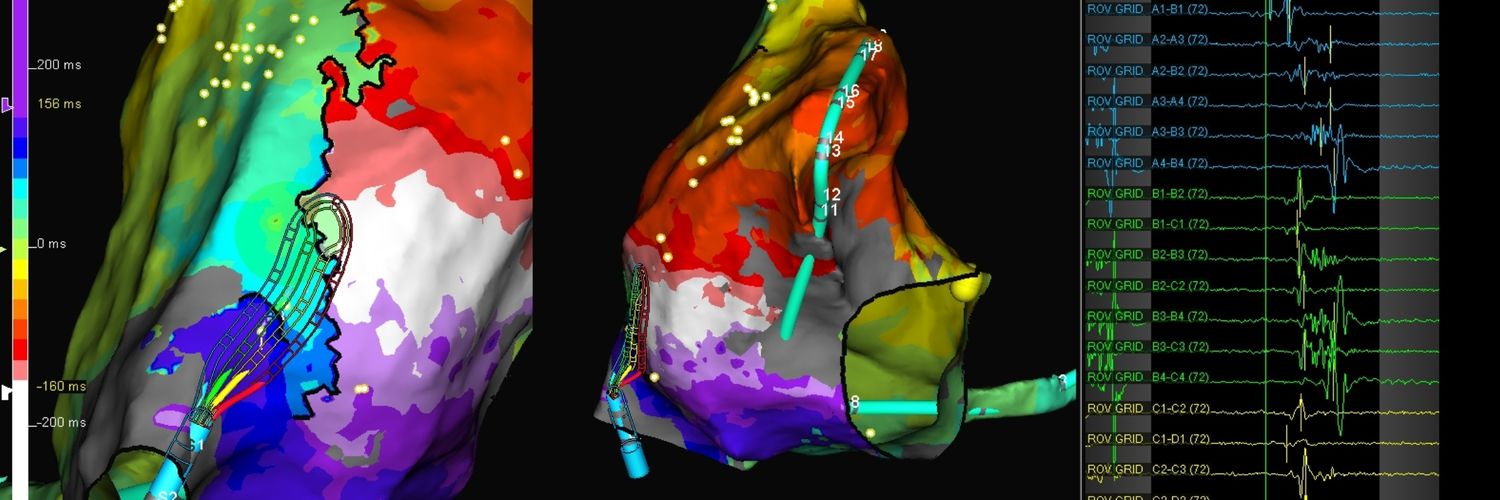 Kristin Pallister banner