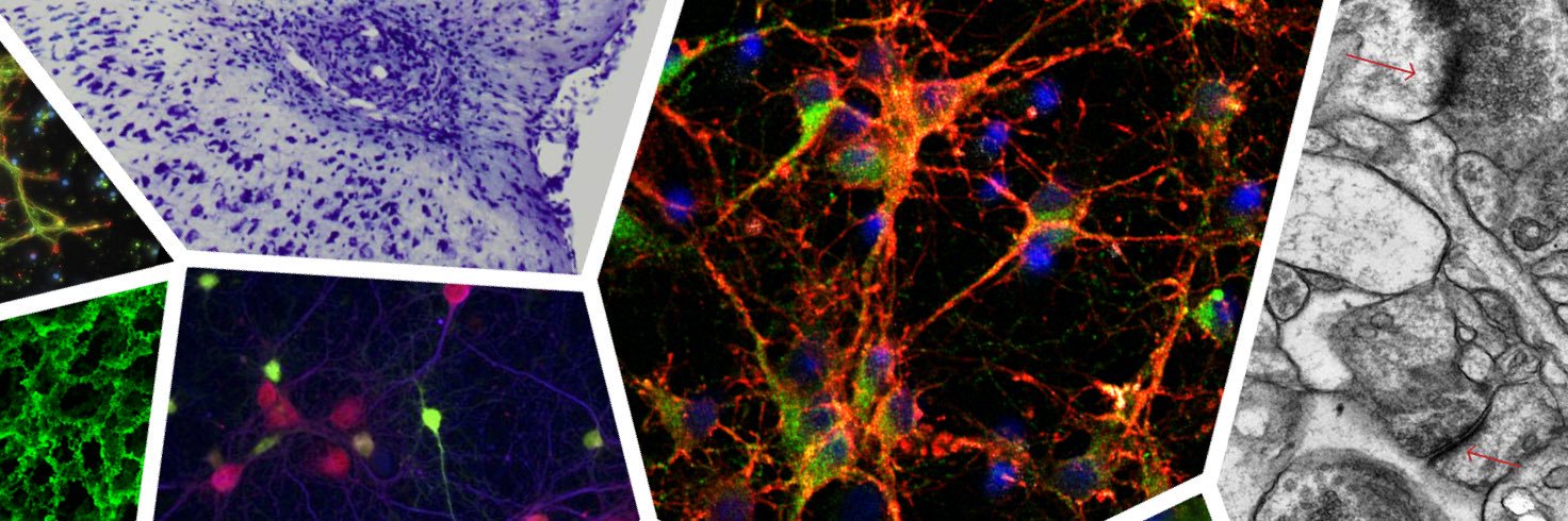 nBTT | Pêgo Lab banner