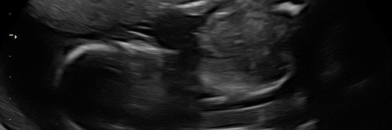 Ellen Jansson banner