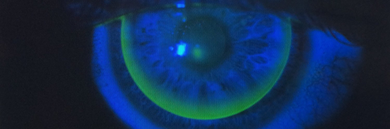 ultralentes's profile banner image