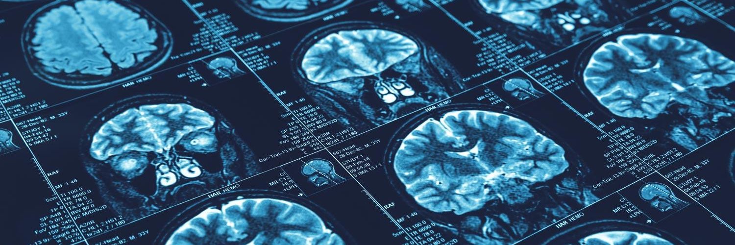 UVA Brain Institute banner