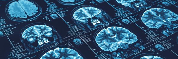 UVA_Brain Profile Banner