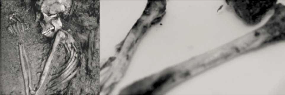 James Watterson banner