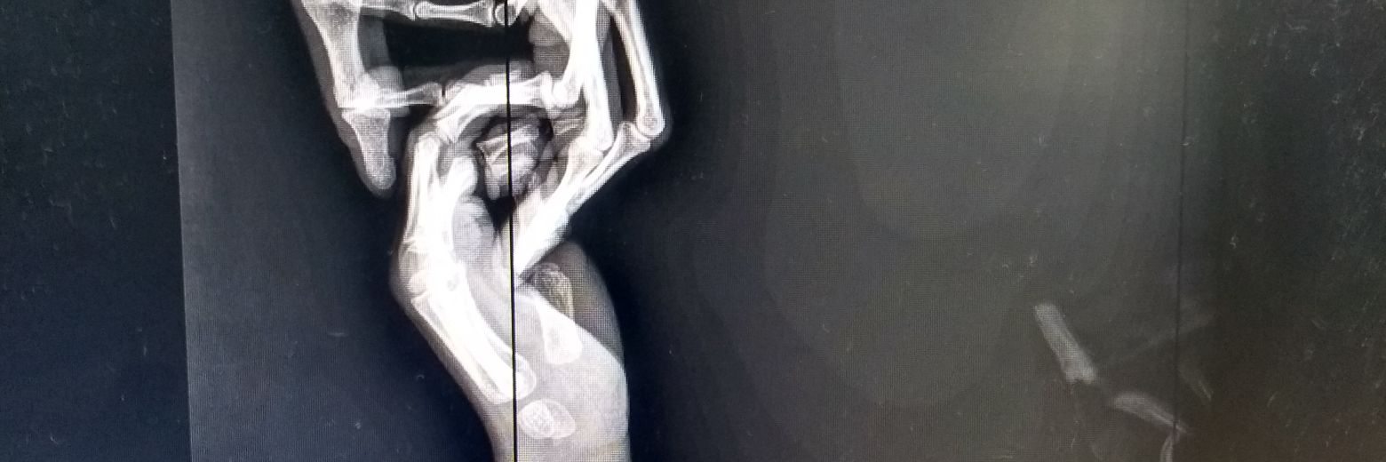 Alan RT banner