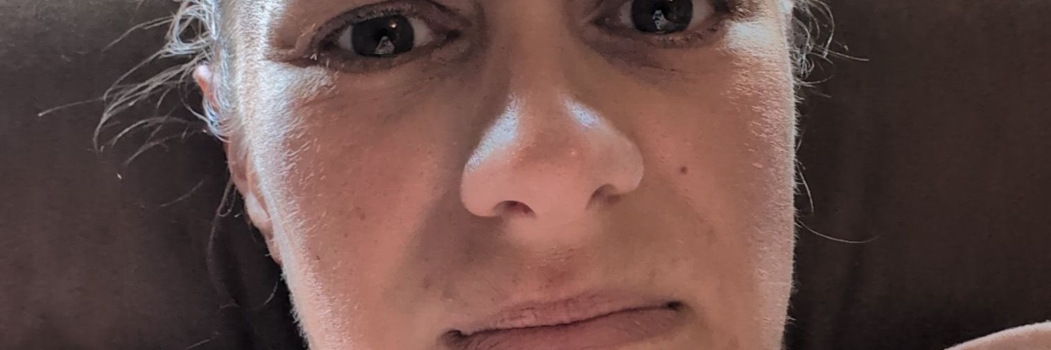 Bane of TopLobstas existence banner