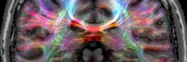 Finn Rabe banner
