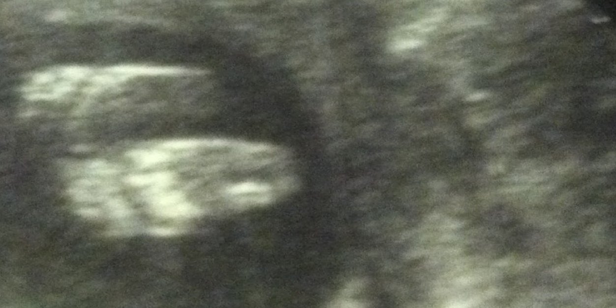 BThuman's profile banner image
