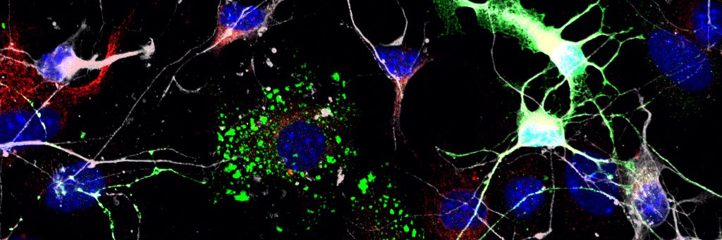 Mateja Rybiczka-Tesulov banner