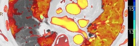 Gopal Punjabi banner