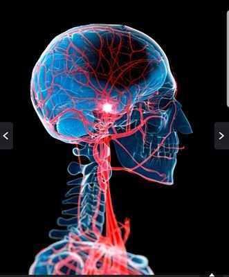 Tweets from the multidisciplinary medical, nursing and therapies team on the Hyper Acute Stroke Unit (HASU), HASU ED, A10 and E1.