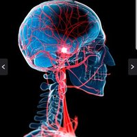 Stockport Stroke Team (@hasuhill) 's Twitter Profile