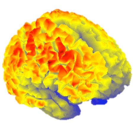 The UCL Centre for Neuroimaging Techniques (CNT) is a virtual centre linking together UCL groups working on the development and optimisation of brain imaging.