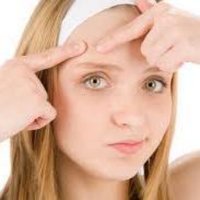 Acne Elimination (@acneelimination) 's Twitter Profile