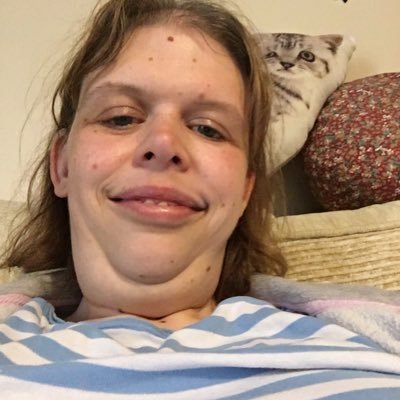 Hi all I'm katy 31 uk has Williams syndrome loves theatre life and asmr audios and videos work at the groundlings theatre 🎭 😊❤️❤️
