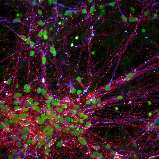 Professor of Neurology @UCL @TheCrick @LabGandhi researches Parkinson’s