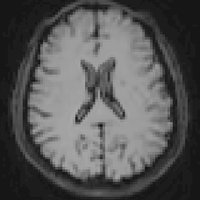 ISMRM White Matter Study Group(@wmsgISMRM) 's Twitter Profile Photo