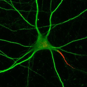 Centre for Developmental Neurobiology - KCL.