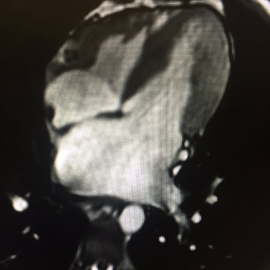 CVimaging_HF's profile picture. A home for those who love cardiovascular magnetic resonance, cardiovascular computed tomography, echocardiography, and heart failure.
