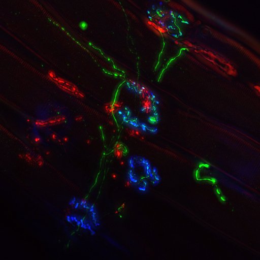 Ngo Lab at UQ. Investigating mechanisms of neurodegeneration and ageing. Researching across the clinic and the lab.