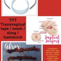 Gold Coast Pelvic Mesh Support (@angelaspaniak) 's Twitter Profile Photo