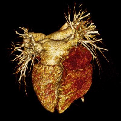 Novel Imaging for Cardiopulmonary Disease | @UCSDJacobs - @UCSDBE, @UCSDHealth - @UCSDImaging | @pennbioeng and @JHUBME alum