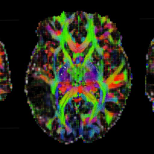 Neurologist+Neuroscientists: cognitive neuroscience, stroke, vascular cognitive impairment, aphasia, dementia. mum of 3.views my own.https://t.co/PyyYcbYery