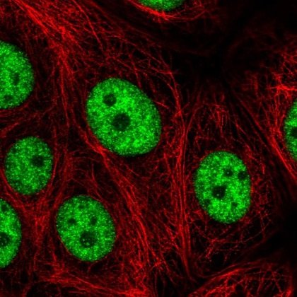 Studying the RNA biology of the immune system.