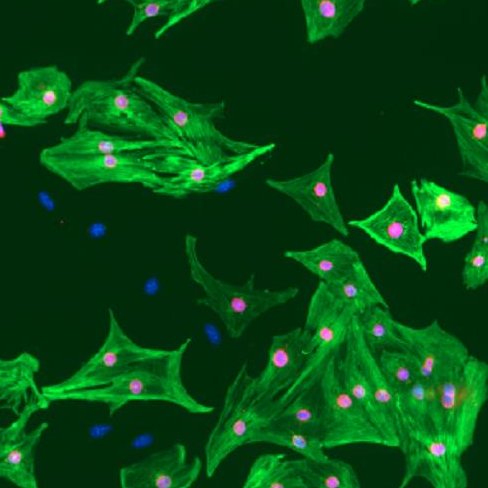 prasad_vik's profile picture. Scientist | Striated Muscle Biology |