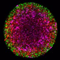 Haass_Melanoma_lab (@haasslab) 's Twitter Profile Photo Haass_Melanoma_lab (@haasslab) 's Twitter Profile Photo