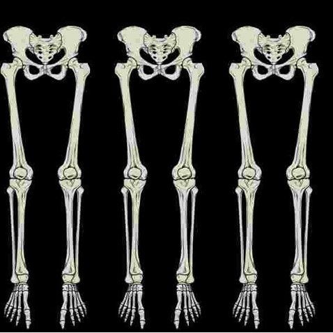 Developing and implementing guidelines for the treatment and management of prosthetic hip infection.