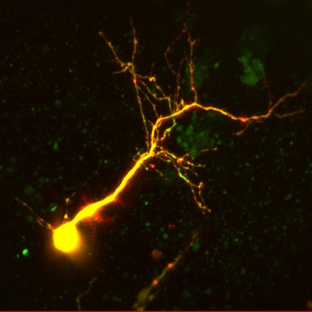 computational microscopy and tools for brain imaging.
Recently moved to @AllenInstitute from @HHMIJanelia