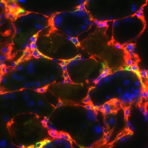 embofibrosis's profile picture. FEBS EMBO LECTURE COURSE Molecular Mechanisms of TIssue Injury, Repair and Fibrosis. 23-31 May 2019